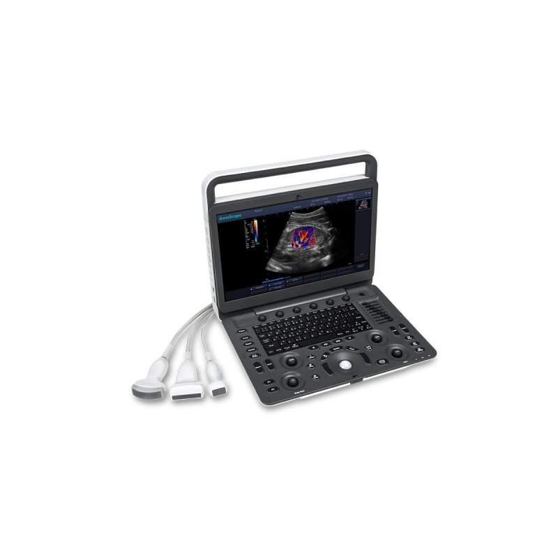Table Top Ultrasound